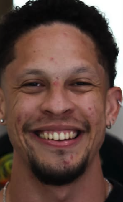 Antes das lentes em resina composta