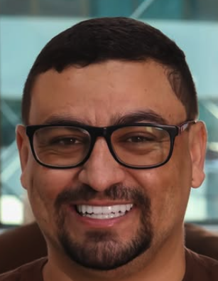 Depois das lentes em resina composta